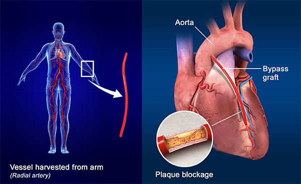 Best cardiology hospital in india - Medicturist.com