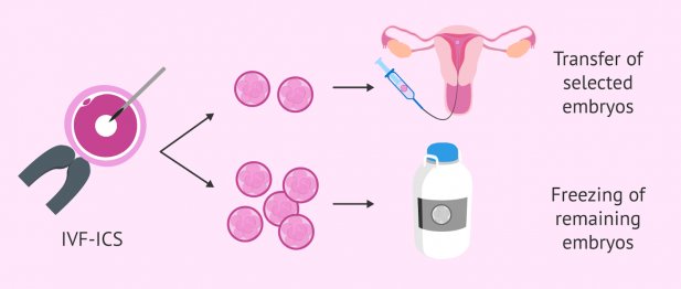 How Long Can Embryos Be Safely Frozen and Stored? Article - ArticleTed -  News and Articles