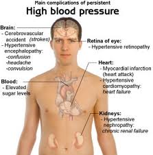 Homeopathy for Hypertension | Homeopathic Medicine for Hypertension